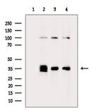 PTGR1 Antibody in Western Blot (WB)