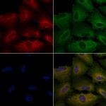 NOX5 Antibody in Immunocytochemistry (ICC/IF)