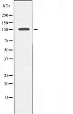 N4BP1 Antibody in Western Blot (WB)