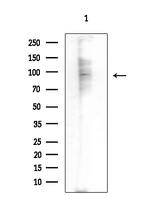 N4BP1 Antibody in Western Blot (WB)