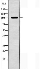 NCAM2 Antibody in Western Blot (WB)