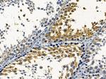 SLC6A15 Antibody in Immunohistochemistry (Paraffin) (IHC (P))