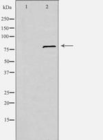 SLC6A15 Antibody in Western Blot (WB)