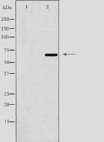 N4BP2L2 Antibody in Western Blot (WB)