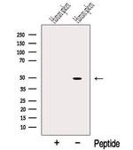 Protein C Inhibitor Antibody in Western Blot (WB)