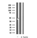 KCNK12 Antibody in Western Blot (WB)