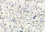 SF3B14 Antibody in Immunohistochemistry (Paraffin) (IHC (P))