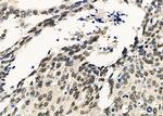 SF3B14 Antibody in Immunohistochemistry (Paraffin) (IHC (P))