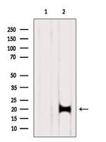 SF3B14 Antibody in Western Blot (WB)