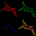 PPP1R16B Antibody in Immunocytochemistry (ICC/IF)