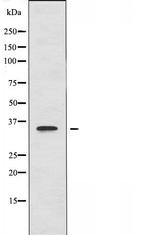 PPP1R3C Antibody in Western Blot (WB)