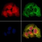 SSH3 Antibody in Immunocytochemistry (ICC/IF)