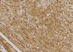 SSH3 Antibody in Immunohistochemistry (Paraffin) (IHC (P))