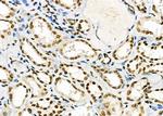 SSH3 Antibody in Immunohistochemistry (Paraffin) (IHC (P))