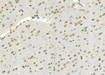 SSH3 Antibody in Immunohistochemistry (Paraffin) (IHC (P))