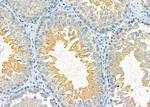 PDXDC1 Antibody in Immunohistochemistry (Paraffin) (IHC (P))