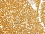 RAB3GAP2 Antibody in Immunohistochemistry (Paraffin) (IHC (P))