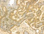 RAB3GAP2 Antibody in Immunohistochemistry (Paraffin) (IHC (P))