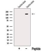 RAB3GAP2 Antibody in Western Blot (WB)