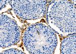 RABL2A Antibody in Immunohistochemistry (Paraffin) (IHC (P))