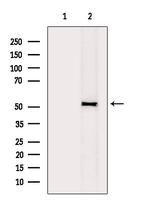 RSAD1 Antibody in Western Blot (WB)