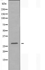 RAB18 Antibody in Western Blot (WB)