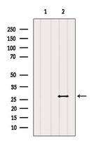 RAB20 Antibody in Western Blot (WB)