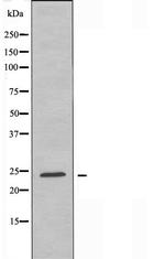 RAB2A Antibody in Western Blot (WB)