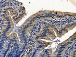 RAB31 Antibody in Immunohistochemistry (Paraffin) (IHC (P))