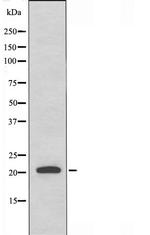 RAB31 Antibody in Western Blot (WB)