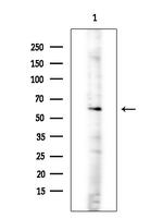 ARHGEF7 Antibody in Western Blot (WB)