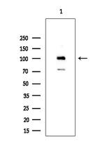 TLK2 Antibody in Western Blot (WB)