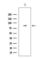 TLK2 Antibody in Western Blot (WB)