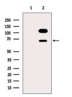 PPP2R1B Antibody in Western Blot (WB)