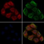 SHB Antibody in Immunocytochemistry (ICC/IF)