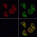 SCN4B Antibody in Immunocytochemistry (ICC/IF)