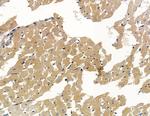 SCN4B Antibody in Immunohistochemistry (Paraffin) (IHC (P))