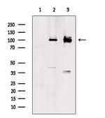 SLC9A6 Antibody in Western Blot (WB)