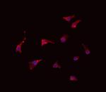 SLC28A2 Antibody in Immunocytochemistry (ICC/IF)