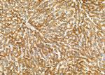 SLC24A3 Antibody in Immunohistochemistry (Paraffin) (IHC (P))