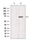 SLC5A6 Antibody in Western Blot (WB)