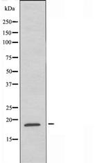 SNX3 Antibody in Western Blot (WB)