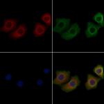 STMN3 Antibody in Immunocytochemistry (ICC/IF)