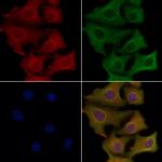 SVOP Antibody in Immunocytochemistry (ICC/IF)