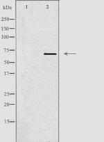 TBX18 Antibody in Western Blot (WB)