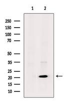 UBE2T Antibody in Western Blot (WB)