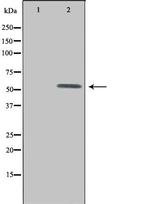 UEVLD Antibody in Western Blot (WB)