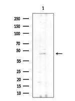 UEVLD Antibody in Western Blot (WB)