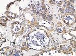 VTI1A Antibody in Immunohistochemistry (Paraffin) (IHC (P))