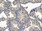 VTI1A Antibody in Immunohistochemistry (Paraffin) (IHC (P))